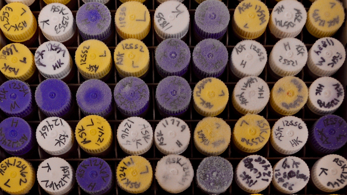 Vials of frozen tissues